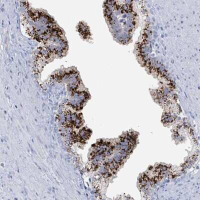 Immunohistochemistry-Paraffin: Kallikrein 4/Prostase/EMSP1 Antibody [NBP2-14171]