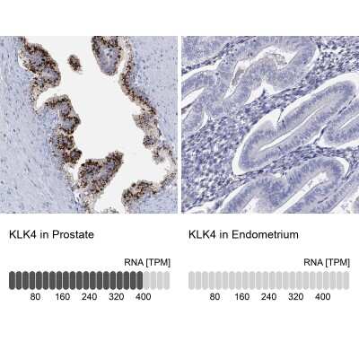 Immunohistochemistry-Paraffin: Kallikrein 4/Prostase/EMSP1 Antibody [NBP2-14171]