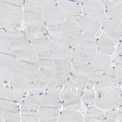 Immunohistochemistry-Paraffin: Kallikrein 5 Antibody [NBP1-89588]