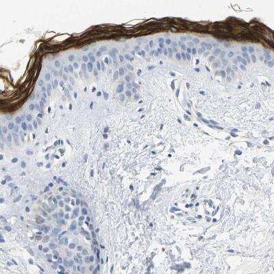 Immunohistochemistry-Paraffin: Kallikrein 5 Antibody [NBP1-89588]