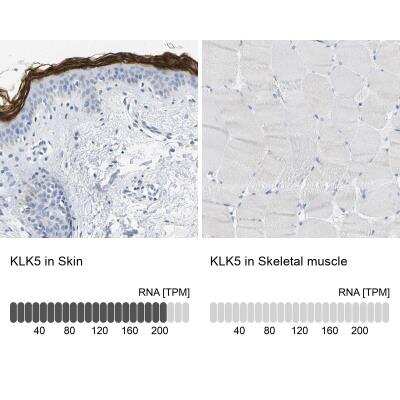 Immunohistochemistry-Paraffin: Kallikrein 5 Antibody [NBP1-89588]