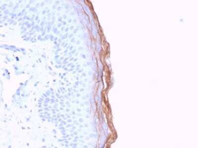 Immunohistochemistry-Paraffin: Kallikrein 5 Antibody (KLK5/3841) [NBP3-07858]