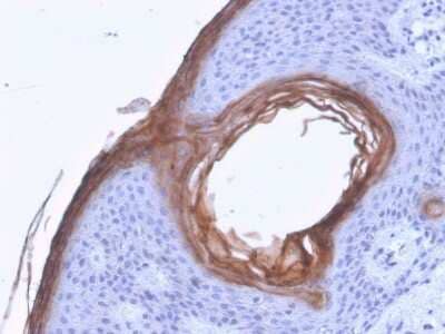 Immunohistochemistry-Paraffin: Kallikrein 5 Antibody (KLK5/3841) - Azide and BSA Free [NBP3-08338]