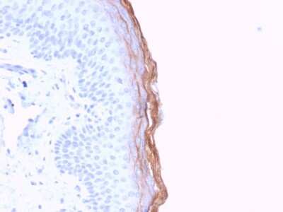 Immunohistochemistry-Paraffin: Kallikrein 5 Antibody (KLK5/3841) - Azide and BSA Free [NBP3-08338]