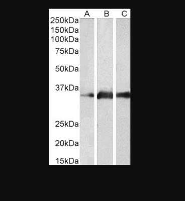 Western Blot: Kallikrein 5 Antibody [NB100-58963]