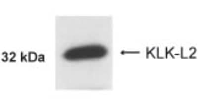 Western Blot: Kallikrein 5 AntibodyBSA Free [NB200-138]