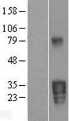 Western Blot: Kallikrein 5 Overexpression Lysate [NBP2-04336]