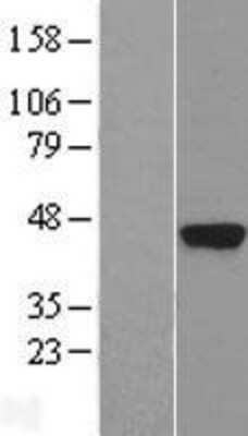 Western Blot: Kallikrein 5 Overexpression Lysate [NBP2-10645]