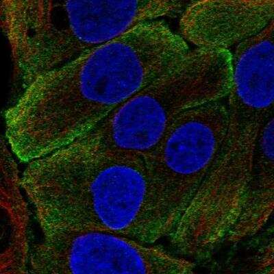 Immunocytochemistry/ Immunofluorescence: Kallikrein 7 Antibody [NBP1-87208]