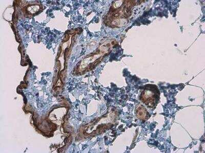 Immunohistochemistry-Paraffin: Kallikrein 7 Antibody [NBP1-31428]