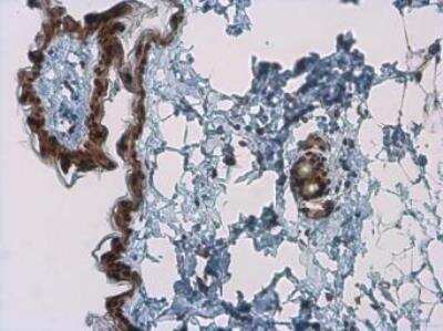 Immunohistochemistry-Paraffin: Kallikrein 7 Antibody [NBP1-32999]