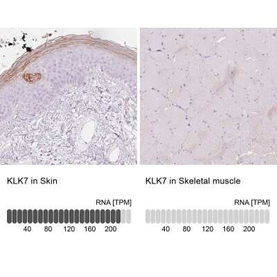 Immunohistochemistry-Paraffin: Kallikrein 7 Antibody [NBP2-38950]