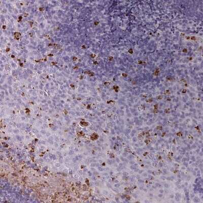Immunohistochemistry-Paraffin: Kallikrein 7 Antibody [NBP2-38950]