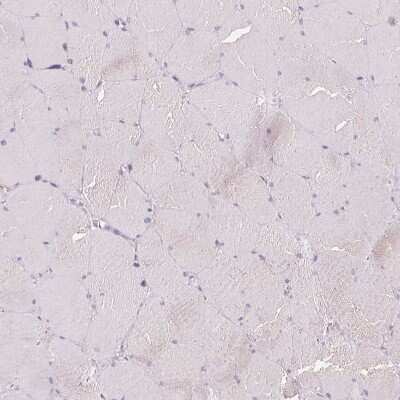 Immunohistochemistry-Paraffin: Kallikrein 7 Antibody [NBP2-38950]