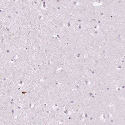 Immunohistochemistry-Paraffin: Kallikrein 7 Antibody [NBP2-38950]