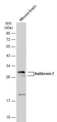 Western Blot: Kallikrein 7 Antibody [NBP1-32999]