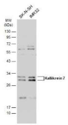 Western Blot: Kallikrein 7 Antibody [NBP1-32999]
