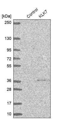 Western Blot: Kallikrein 7 Antibody [NBP1-87208]