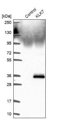 Western Blot: Kallikrein 7 Antibody [NBP2-38950]