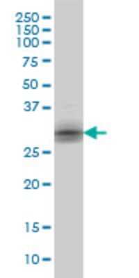 Western Blot: Kallikrein 8/Neuropsin Antibody (2F11) [H00011202-M01]