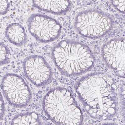 Immunohistochemistry-Paraffin: Kallikrein 8/Neuropsin Antibody [NBP3-05517]