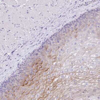 Immunohistochemistry-Paraffin: Kallikrein 8/Neuropsin Antibody [NBP3-05517]