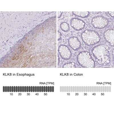 Immunohistochemistry-Paraffin: Kallikrein 8/Neuropsin Antibody [NBP3-05517]