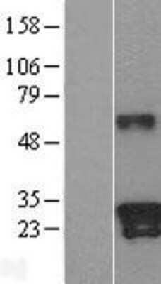 Western Blot: Kallikrein 9 Overexpression Lysate [NBL1-12358]