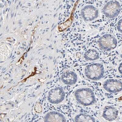 Immunohistochemistry-Paraffin: Serpin A4/Kallistatin Antibody [NBP1-87777]