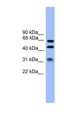 Western Blot: Serpin A4/Kallistatin Antibody [NBP1-79743]