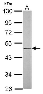 Western Blot: Serpin A4/Kallistatin Antibody [NBP2-17013]