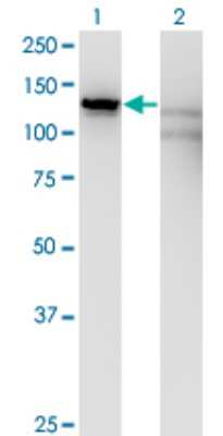 Western Blot: Kanadaptin Antibody (2G10) [H00022950-M01]