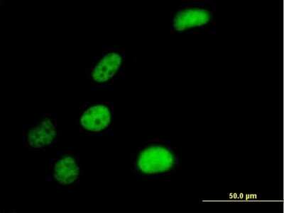 Immunocytochemistry/ Immunofluorescence: Kanadaptin Antibody [H00022950-B01P]