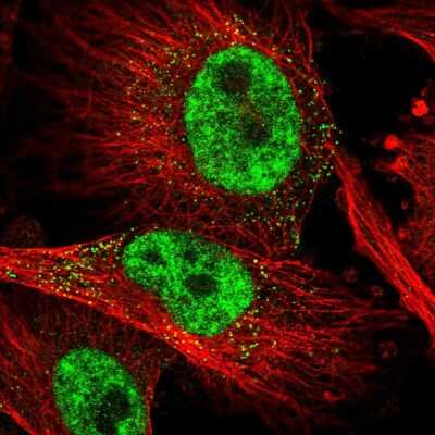 Immunocytochemistry/ Immunofluorescence: Kanadaptin Antibody [NBP2-38315]