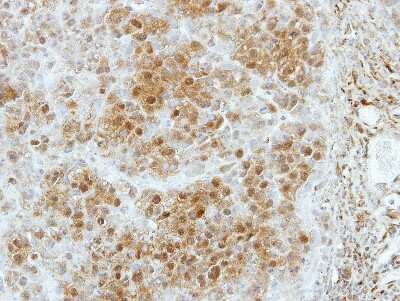 Immunohistochemistry-Paraffin: Kanadaptin Antibody [NBP2-17014]