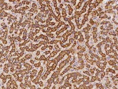 Immunohistochemistry-Paraffin: Kanadaptin Antibody [NBP3-06068]