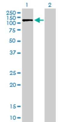 Western Blot: Kanadaptin Antibody [H00022950-B01P]
