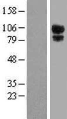 Western Blot: Kanadaptin Overexpression Lysate [NBP2-06861]