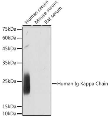 Western Blot: Kappa Light Chain Antibody (5E3S7) [NBP3-15878]