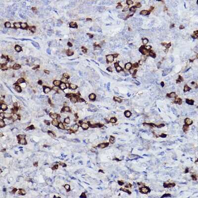 Immunohistochemistry-Paraffin: Kappa Light Chain Antibody (8O7Q9) [NBP3-15596]