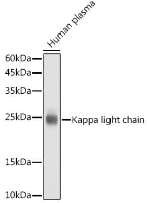 Western Blot: Kappa Light Chain Antibody (8O7Q9) [NBP3-15596]