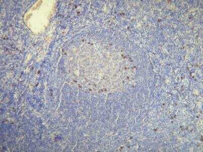 Immunohistochemistry-Paraffin: Kappa Light Chain Antibody (H16-E) [NBP1-30140]