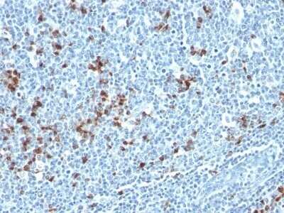 Immunohistochemistry-Paraffin: Kappa Light Chain Antibody (HP6053 + L1C1) - Azide and BSA Free [NBP2-34640]