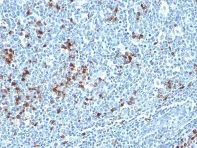 Immunohistochemistry-Paraffin: Kappa Light Chain Antibody (HP6053 + L1C1) - IHC-Prediluted [NBP2-45085]