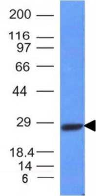 Western Blot: Kappa Light Chain Antibody (HP6053 + L1C1) [NBP2-34258]