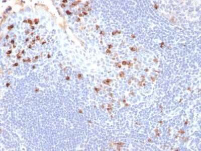 Immunohistochemistry-Paraffin: Kappa Light Chain Antibody (HP6053) [NBP2-34257]