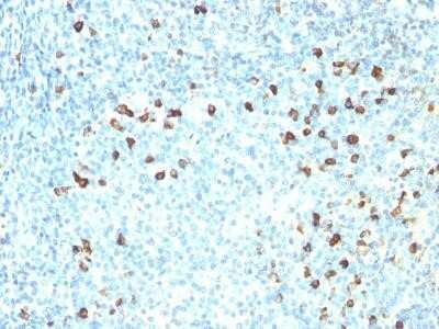 Immunohistochemistry-Paraffin: Kappa Light Chain Antibody (KLC264) - IHC-Prediluted [NBP2-45081]