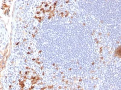 Immunohistochemistry-Paraffin: Kappa Light Chain Antibody (KLC709) - Azide and BSA Free [NBP2-34660]