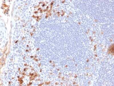 Immunohistochemistry-Paraffin: Kappa Light Chain Antibody (KLC709) - IHC-Prediluted [NBP2-45086]