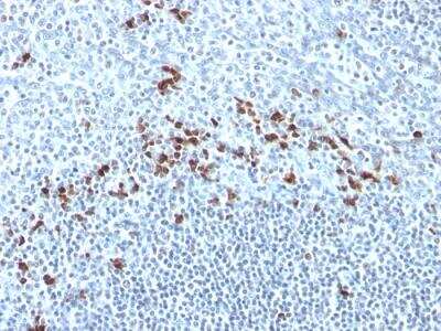 Immunohistochemistry-Paraffin: Kappa Light Chain Antibody (Kap-56) - IHC-Prediluted [NBP2-48354]